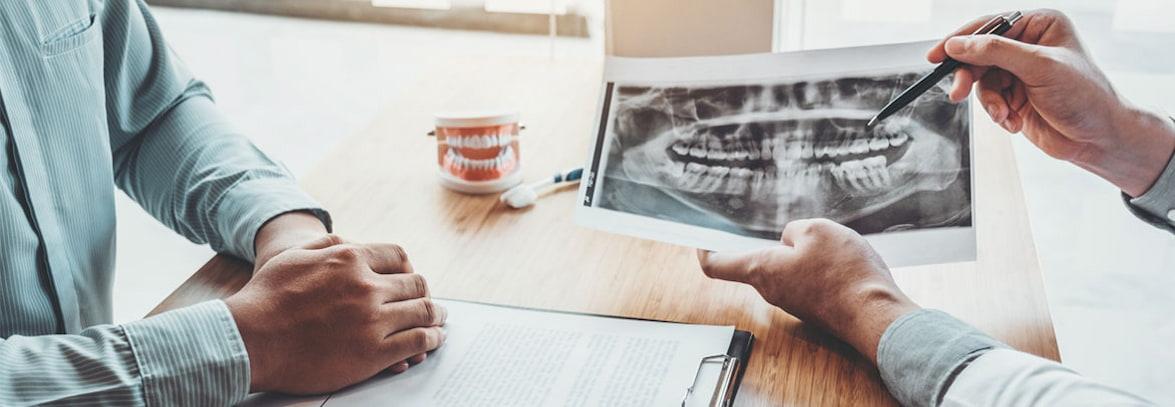 Dental X-Ray